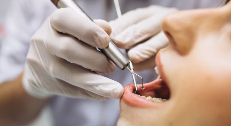 Uniodonto aceita contraproposta do Adufg-Sindicato e plano odontológico será renovado